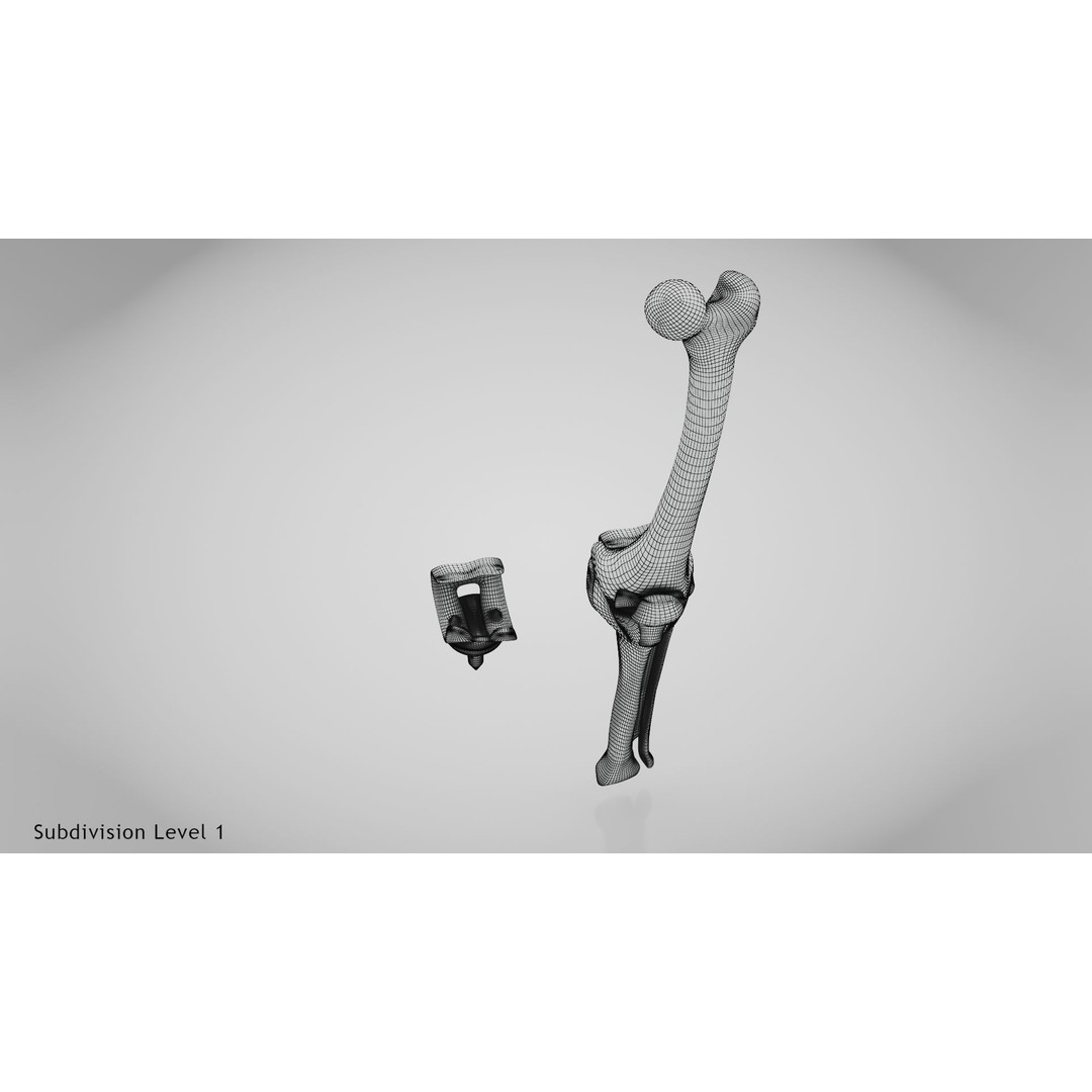 Knee Implant 3D Model – Low Poly Medical Asset, PBR Textures - View 29