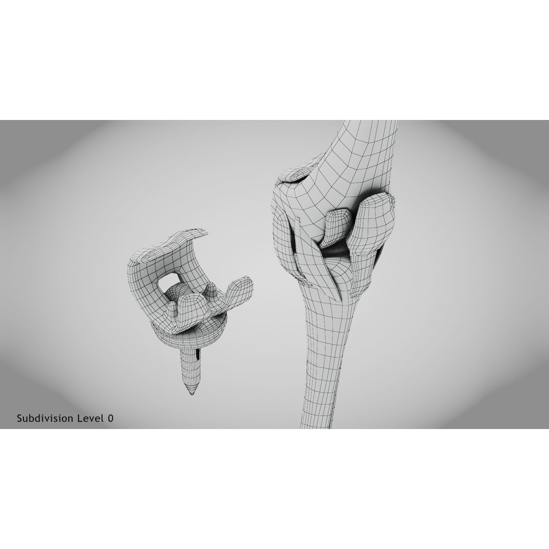 Knee Implant 3D Model – Low Poly Medical Asset, PBR Textures - View 32