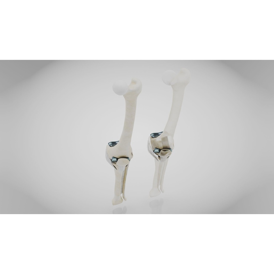 Knee Implant 3D Model – Low Poly Medical Asset, PBR Textures - View 9