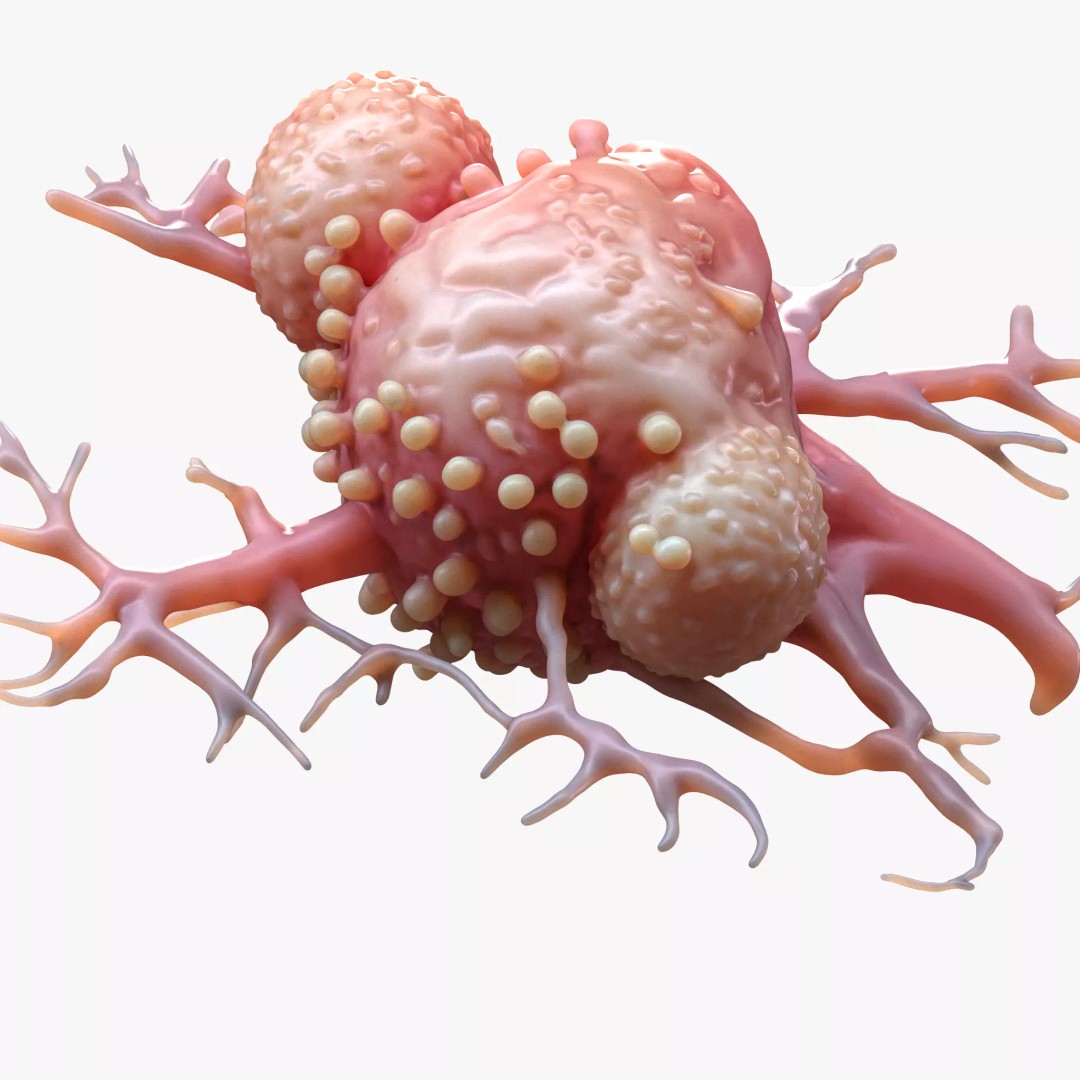 Cancer Cell Tumor 3D Model – High Poly Educational Asset, FBX, OBJ - View 2