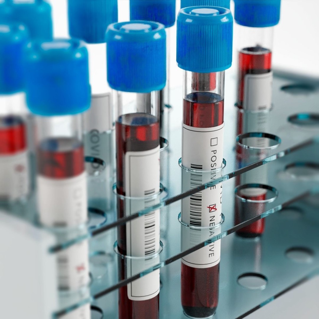 Covid-19 Test Tube Rack 3D Model – Low Poly PBR Lab Asset, FBX - View 10