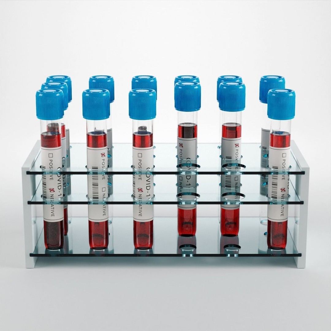 Covid-19 Test Tube Rack 3D Model – Low Poly PBR Lab Asset, FBX - View 8