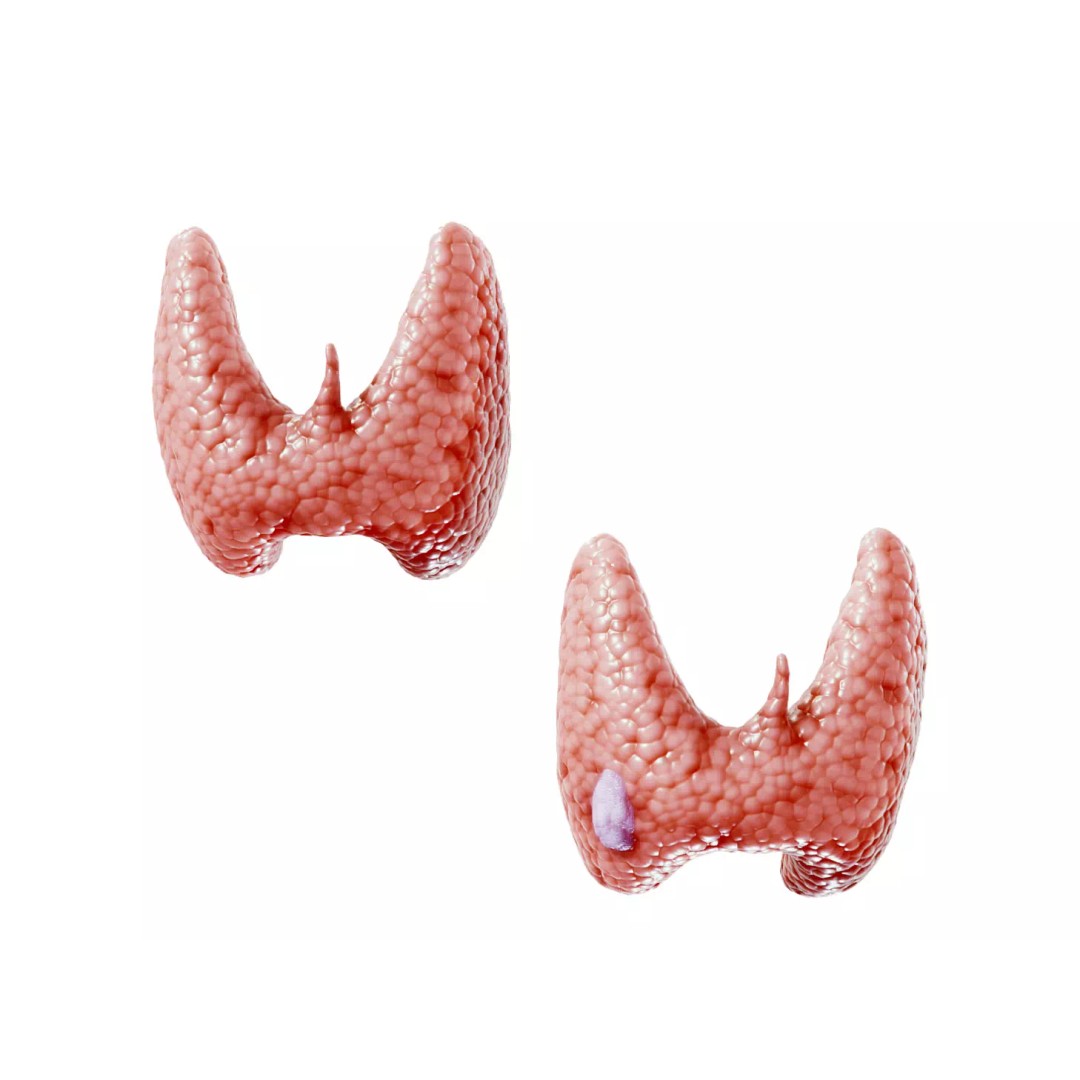 Healthy Thyroid 3D Model – Low Poly Medical Asset, FBX, OBJ - View 2
