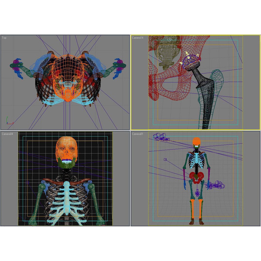 Femoral Prosthesis 3D Model – Anatomical Skeleton with PBR Textures, FBX
