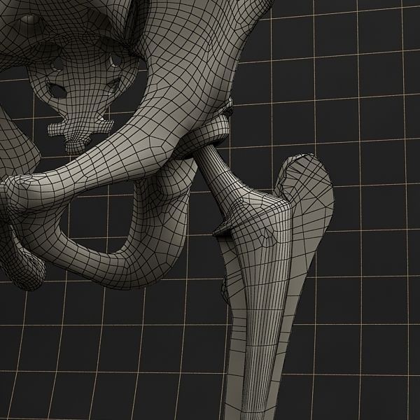Femoral Prosthesis 3D Model – Anatomical Skeleton with PBR Textures, FBX - View 15