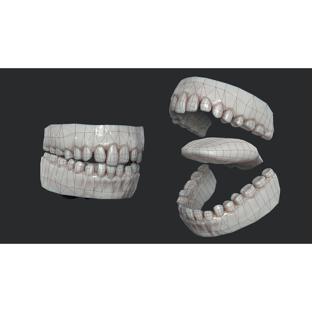Rotten Teeth and Gums 3D Model – Low Poly Character Asset, FBX