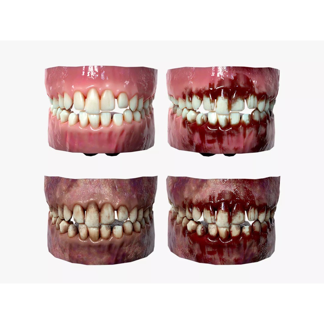 Rotten Teeth and Gums 3D Model – Low Poly Character Asset, FBX - View 2