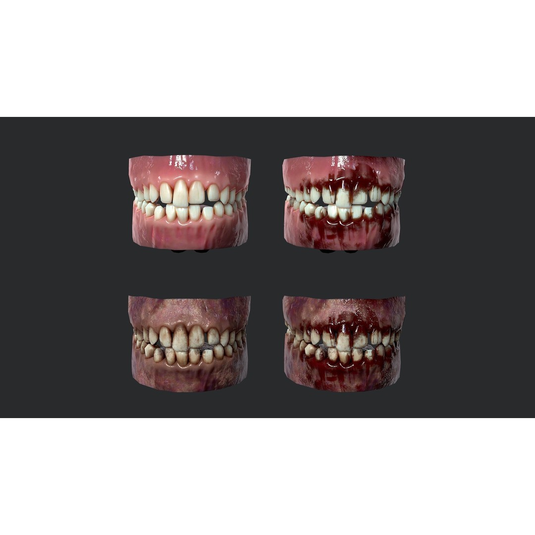 Rotten Teeth and Gums 3D Model – Low Poly Character Asset, FBX - View 3
