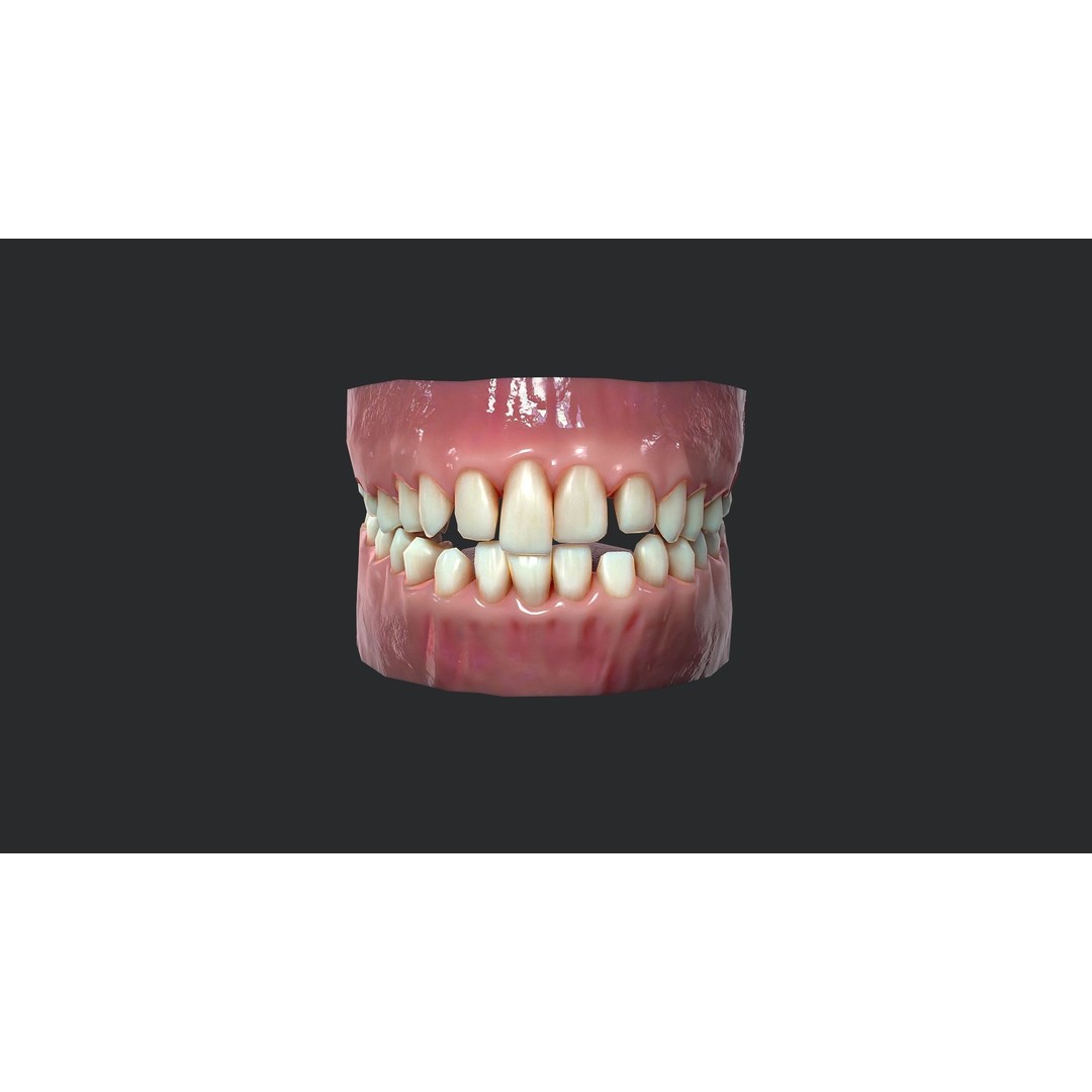Rotten Teeth and Gums 3D Model – Low Poly Character Asset, FBX - View 4