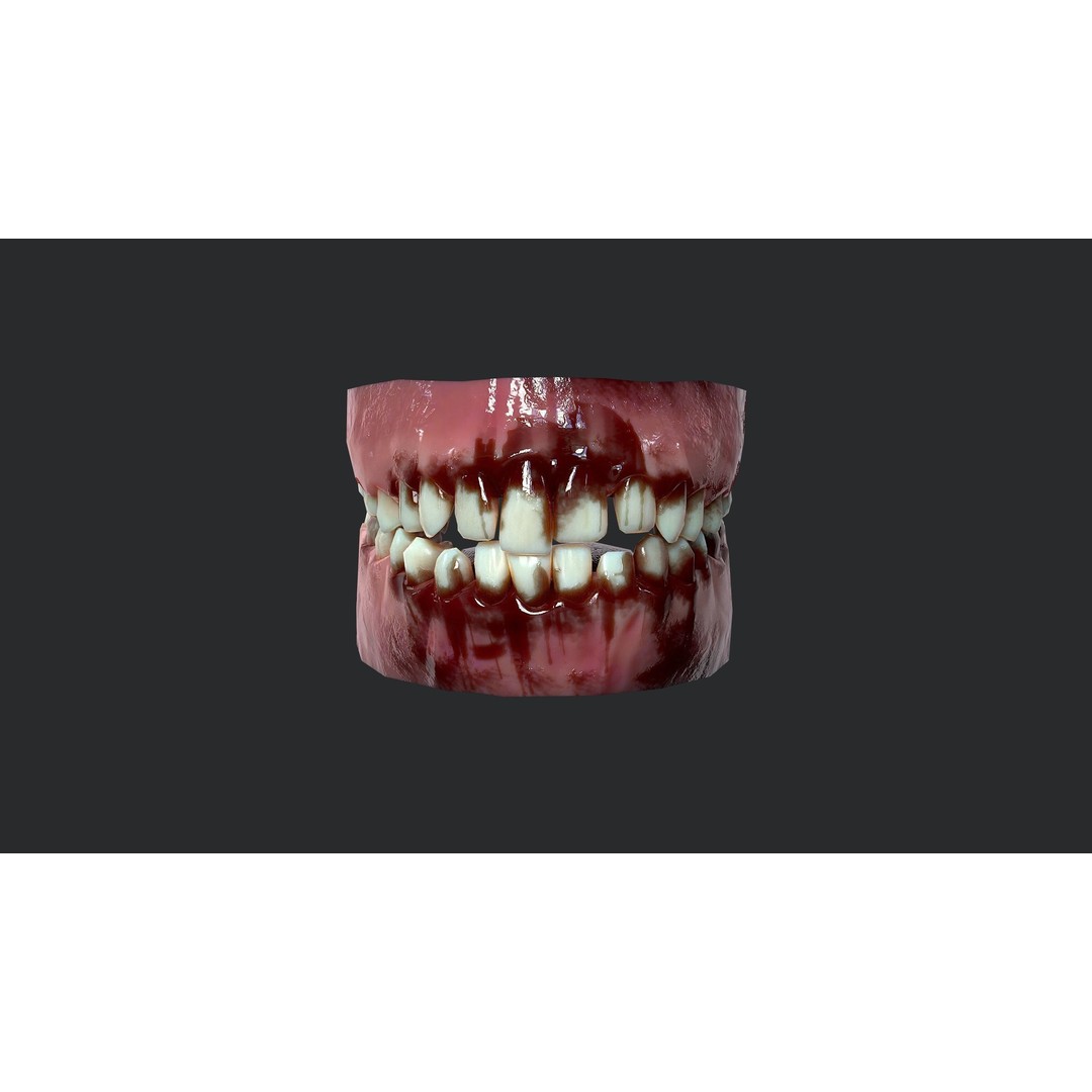 Rotten Teeth and Gums 3D Model – Low Poly Character Asset, FBX - View 5