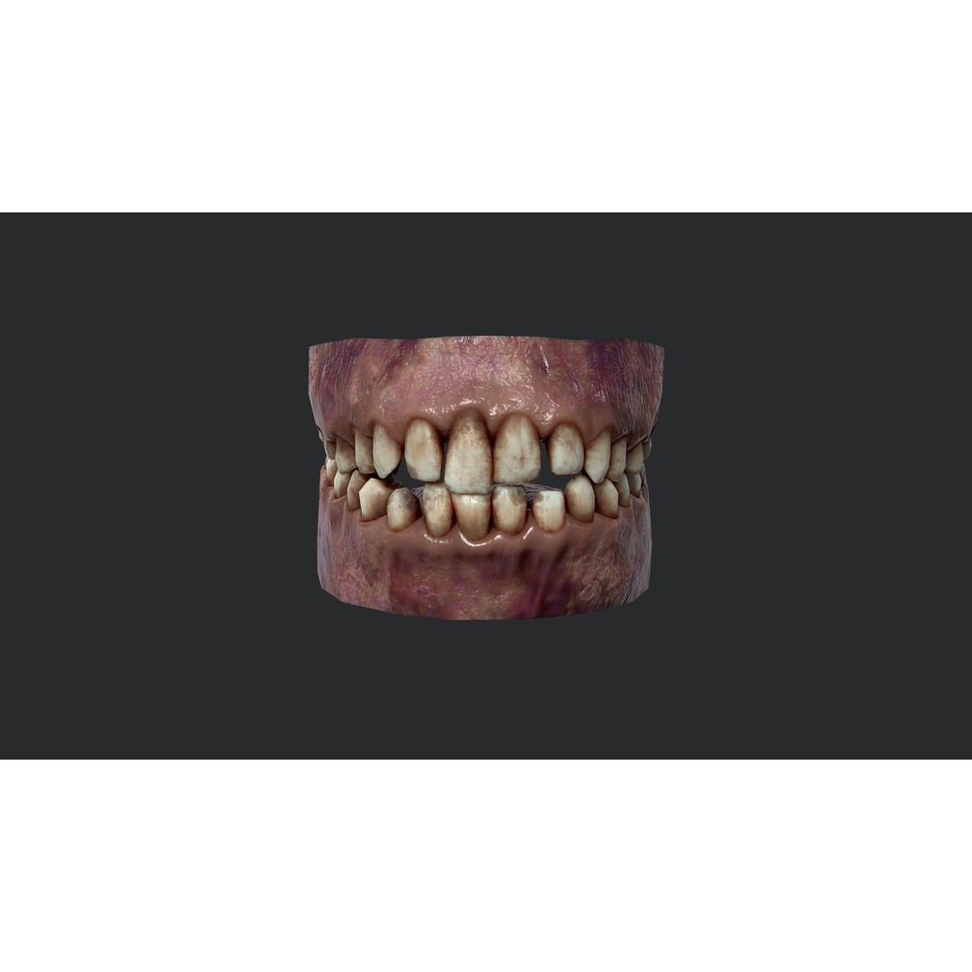 Rotten Teeth and Gums 3D Model – Low Poly Character Asset, FBX - View 6