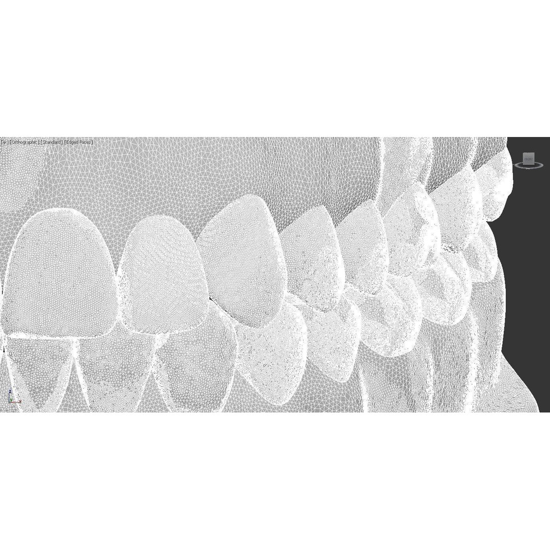 Dental 3D Model – High Poly Scanned Teeth for Rendering and 3D Printing - View 23