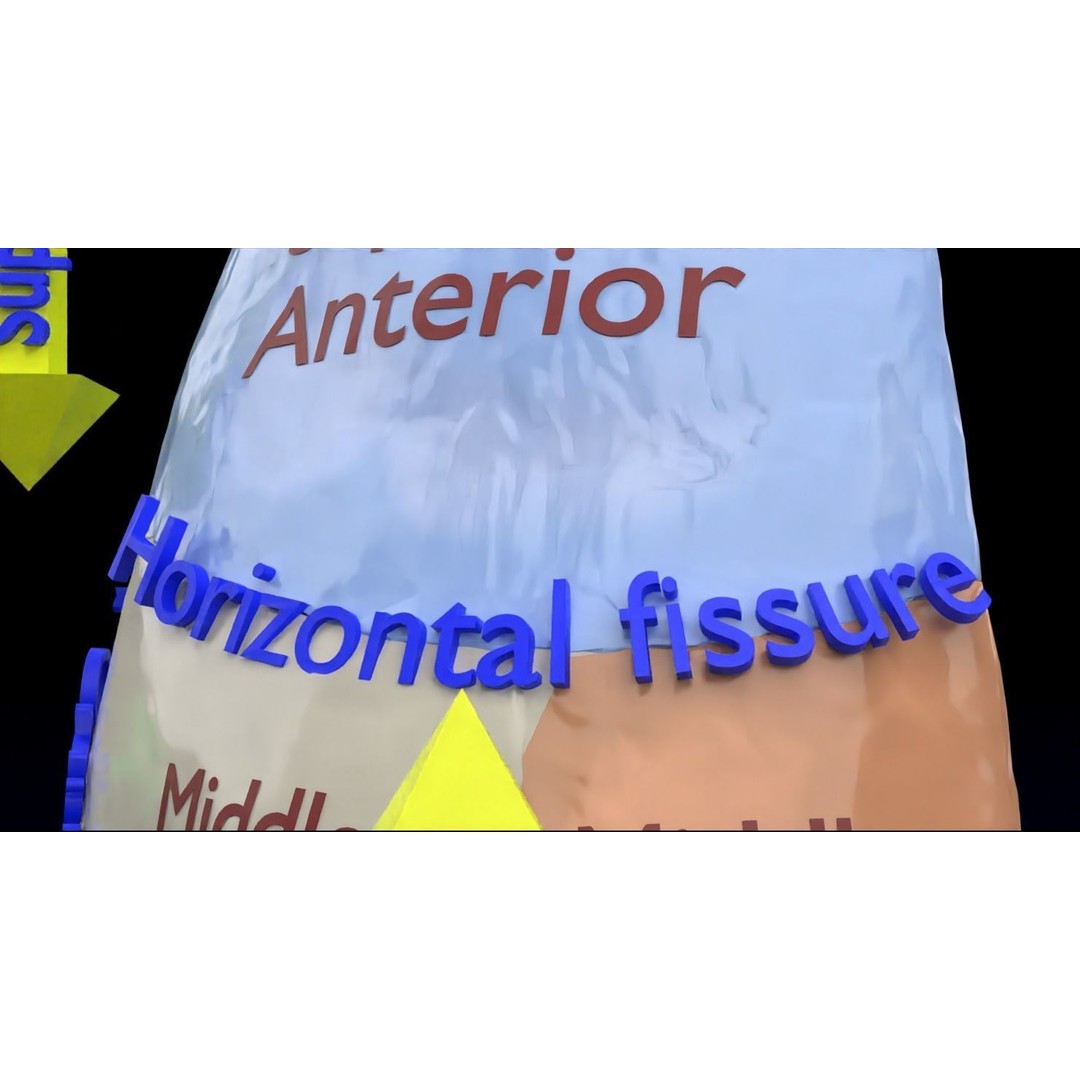 Lung Pulmonary Segment Anatomy 3D Model – Detailed Medical Asset, FBX, OBJ, STL - View 21