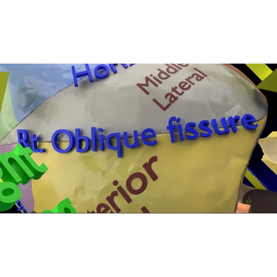 Lung Pulmonary Segment Anatomy 3D Model – Detailed Medical Asset, FBX, OBJ, STL - View 22