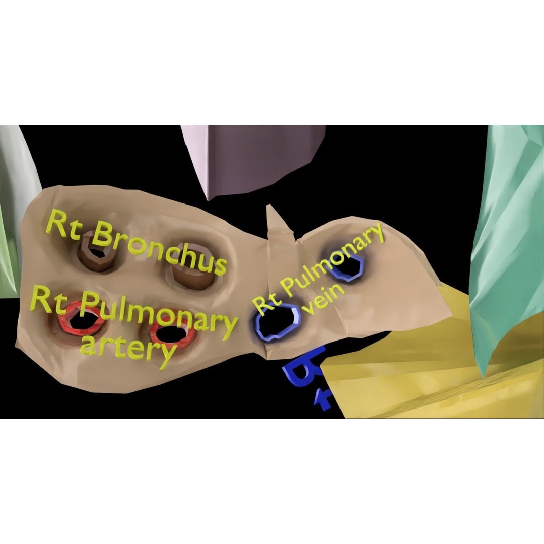 Lung Pulmonary Segment Anatomy 3D Model – Detailed Medical Asset, FBX, OBJ, STL - View 7