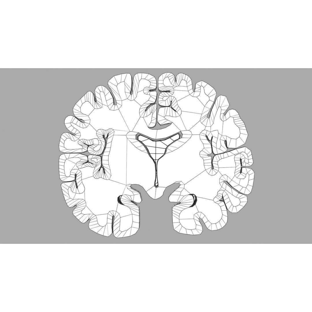 Alzheimer Disease Brain Coronal Slice 3D Model – PBR Textured, Multiple Formats