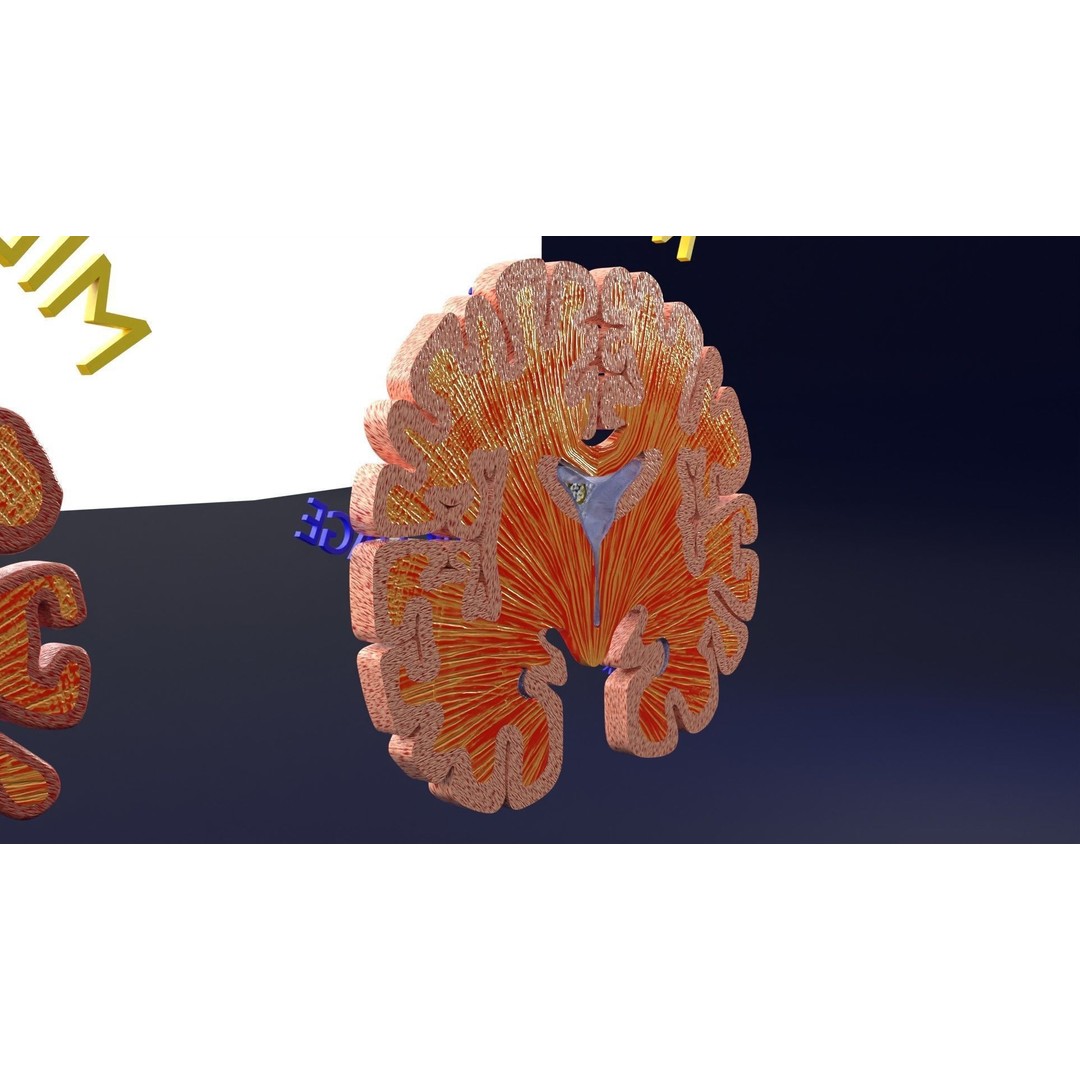 Alzheimer Disease Brain Coronal Slice 3D Model – PBR Textured, Multiple Formats - View 26