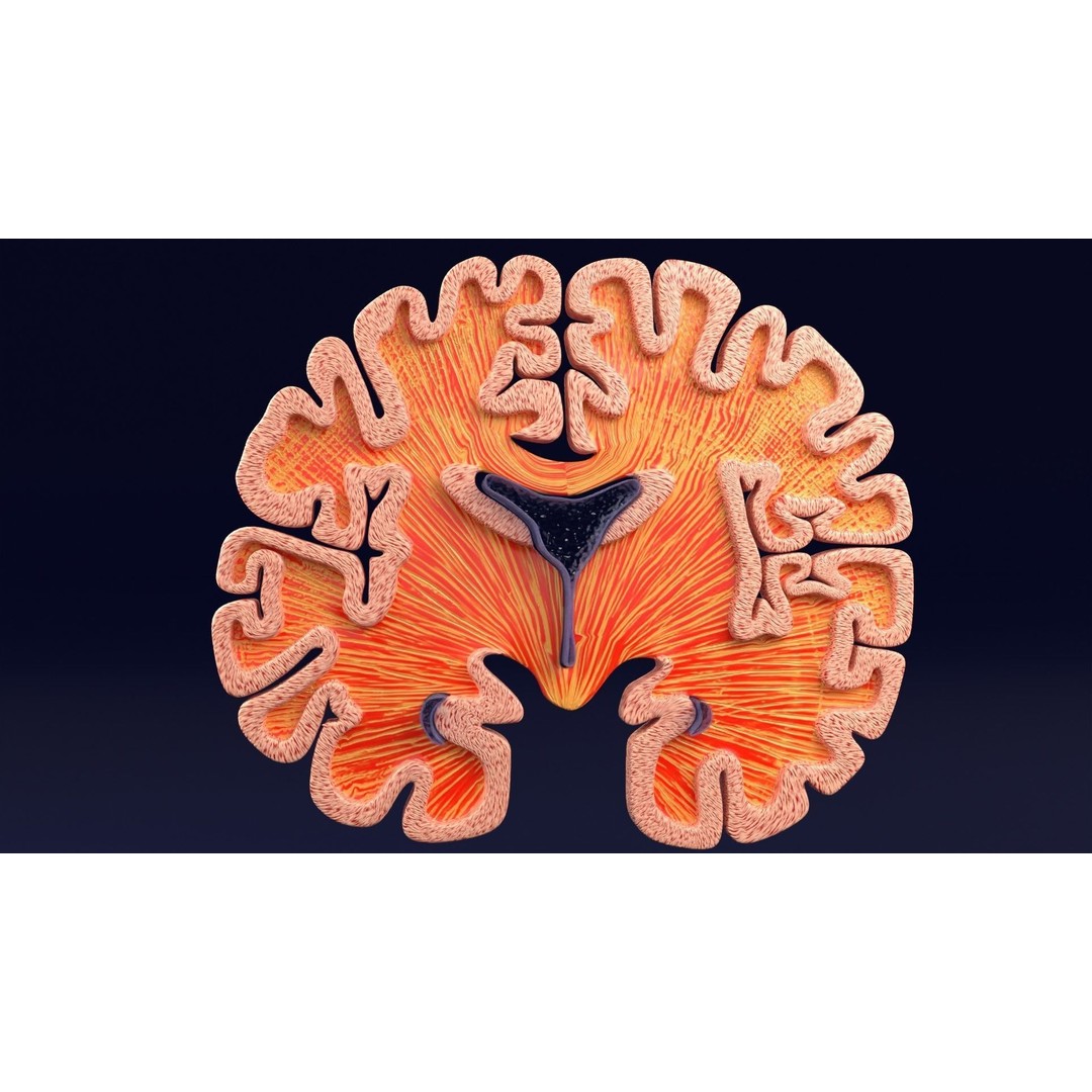 Alzheimer Disease Brain Coronal Slice 3D Model – PBR Textured, Multiple Formats - View 42