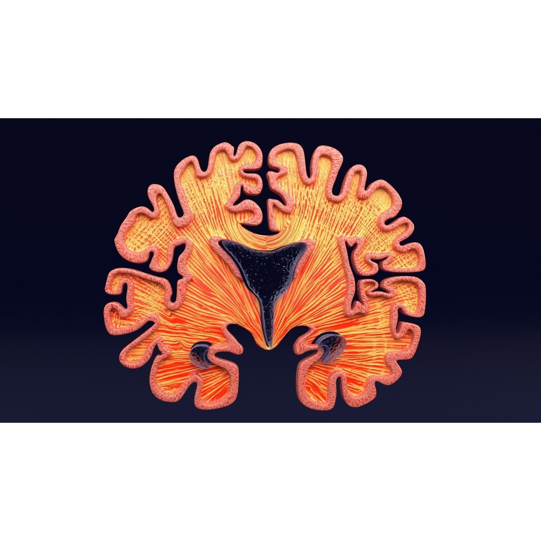 Alzheimer Disease Brain Coronal Slice 3D Model – PBR Textured, Multiple Formats - View 43