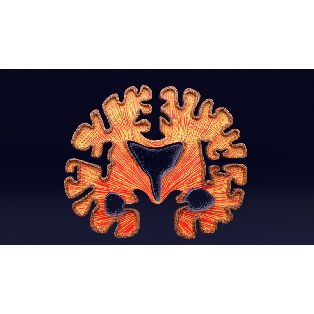 Alzheimer Disease Brain Coronal Slice 3D Model – PBR Textured, Multiple Formats - View 44
