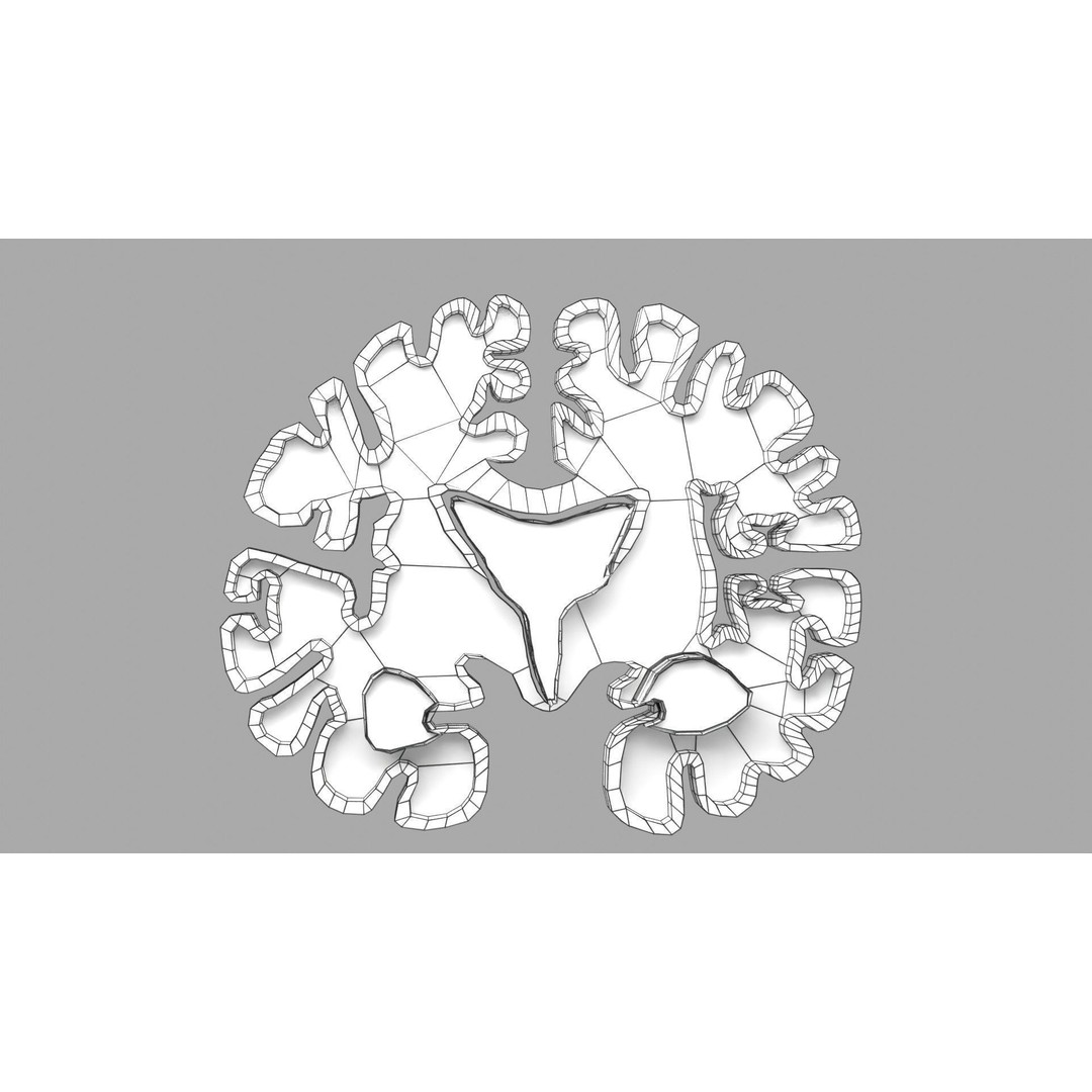 Alzheimer Disease Brain Coronal Slice 3D Model – PBR Textured, Multiple Formats - View 51