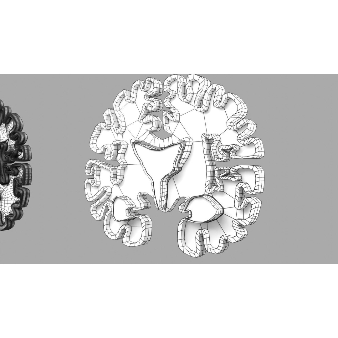 Alzheimer Disease Brain Coronal Slice 3D Model – PBR Textured, Multiple Formats - View 52