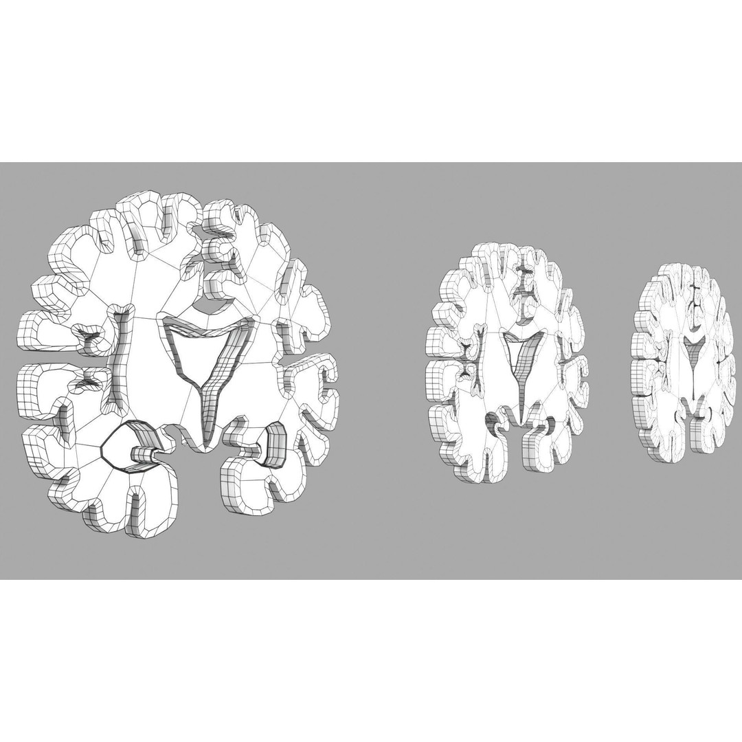 Alzheimer Disease Brain Coronal Slice 3D Model – PBR Textured, Multiple Formats - View 54