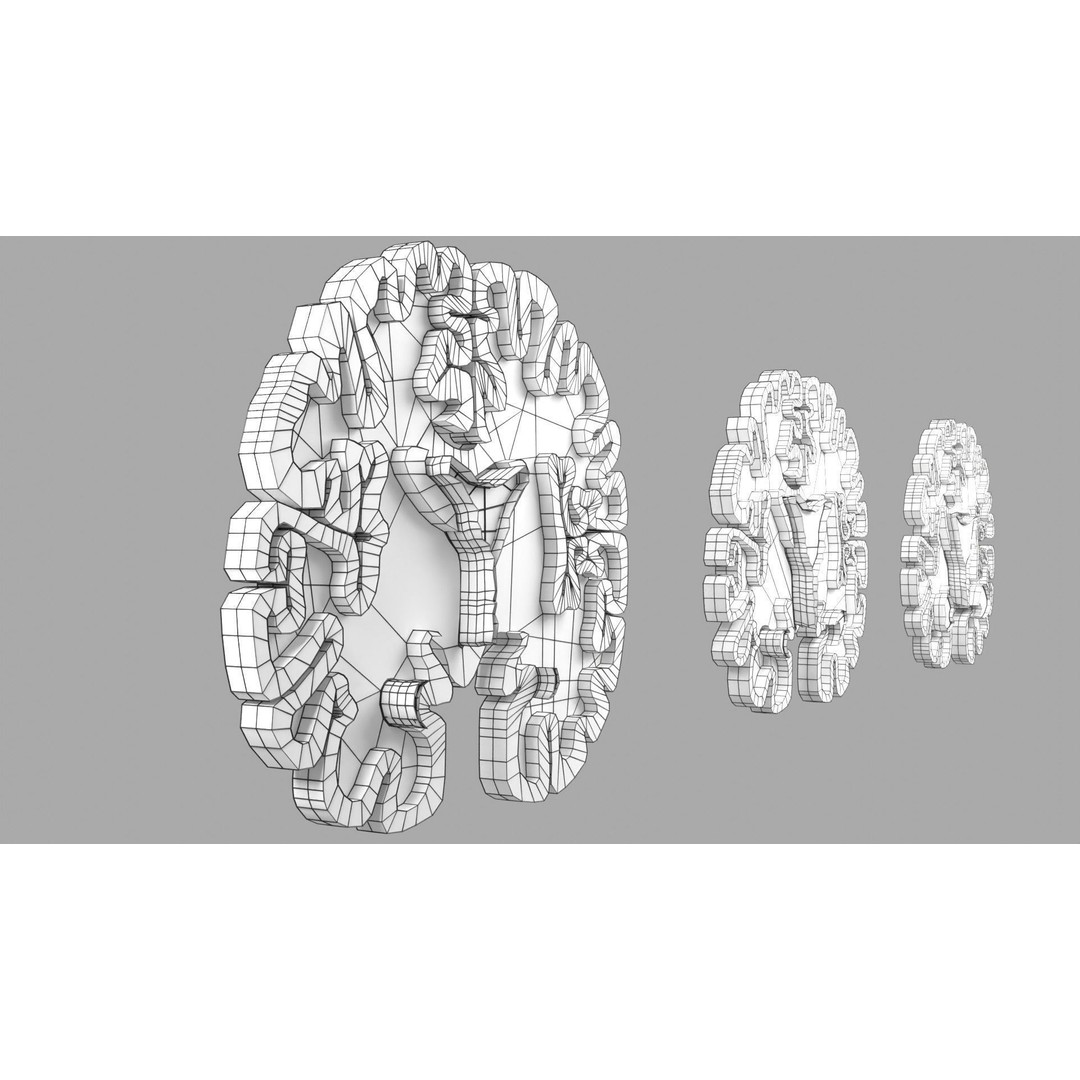 Alzheimer Disease Brain Coronal Slice 3D Model – PBR Textured, Multiple Formats - View 57