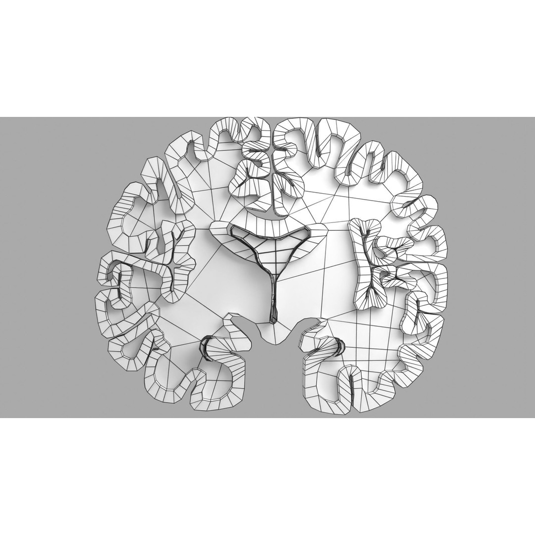 Alzheimer Disease Brain Coronal Slice 3D Model – PBR Textured, Multiple Formats - View 58