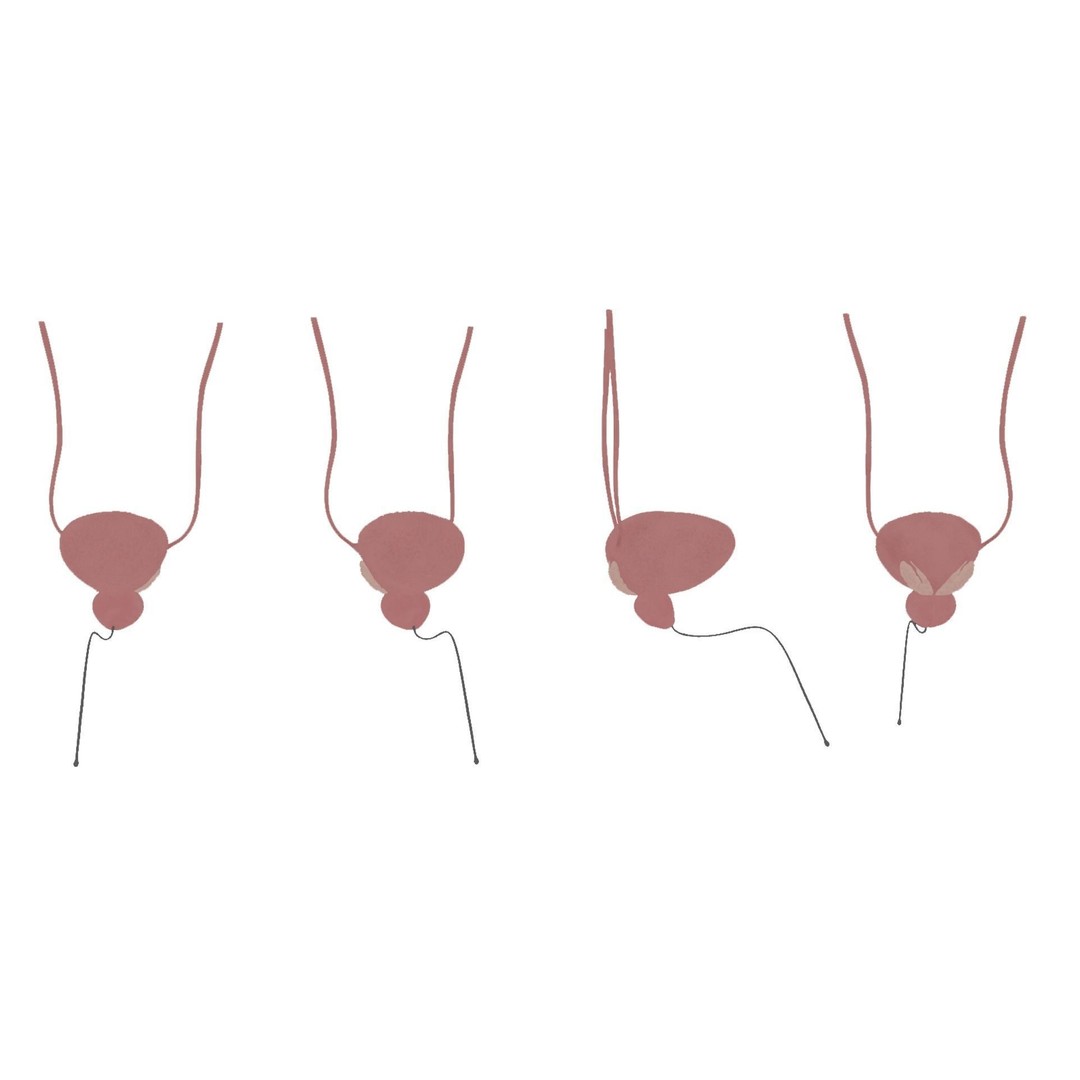 Bladder and Prostate Anatomy 3D Model – Low Poly PBR Medical Asset, FBX - View 9