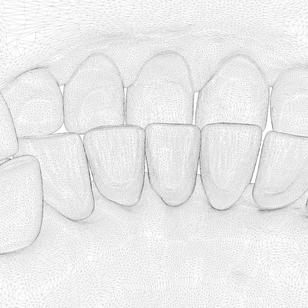 Dentures Mold 3D Model – High Poly Anatomical Asset, FBX, OBJ - View 10