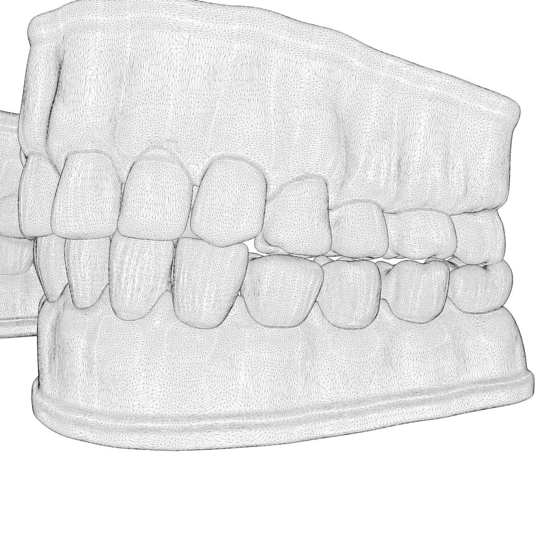 Dentures Mold 3D Model – High Poly Anatomical Asset, FBX, OBJ - View 9
