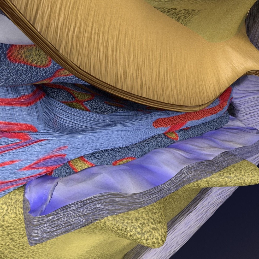 Osteoarthritis 3D Model – Medical Anatomy with Detailed Staging - View 10