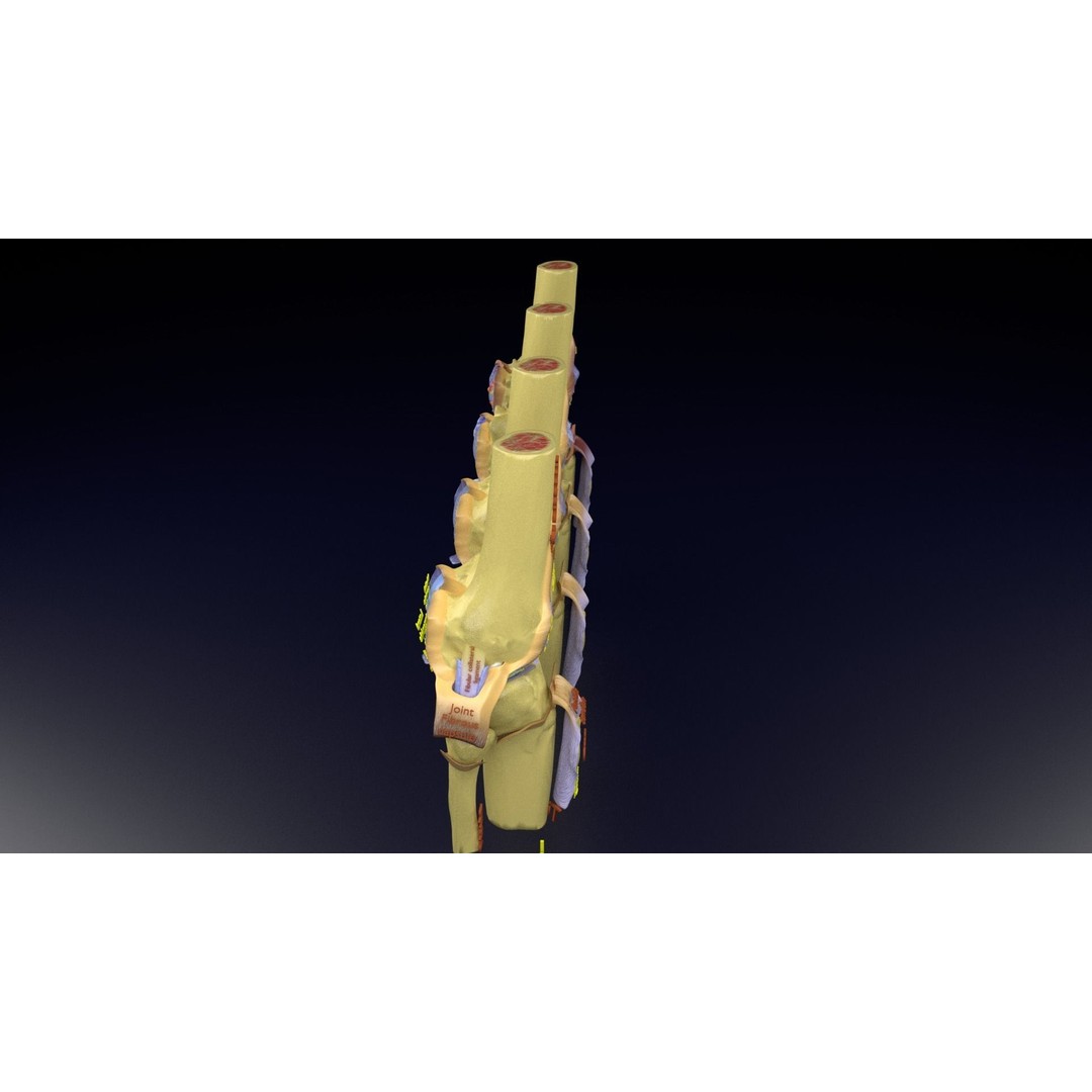 Osteoarthritis 3D Model – Medical Anatomy with Detailed Staging - View 135