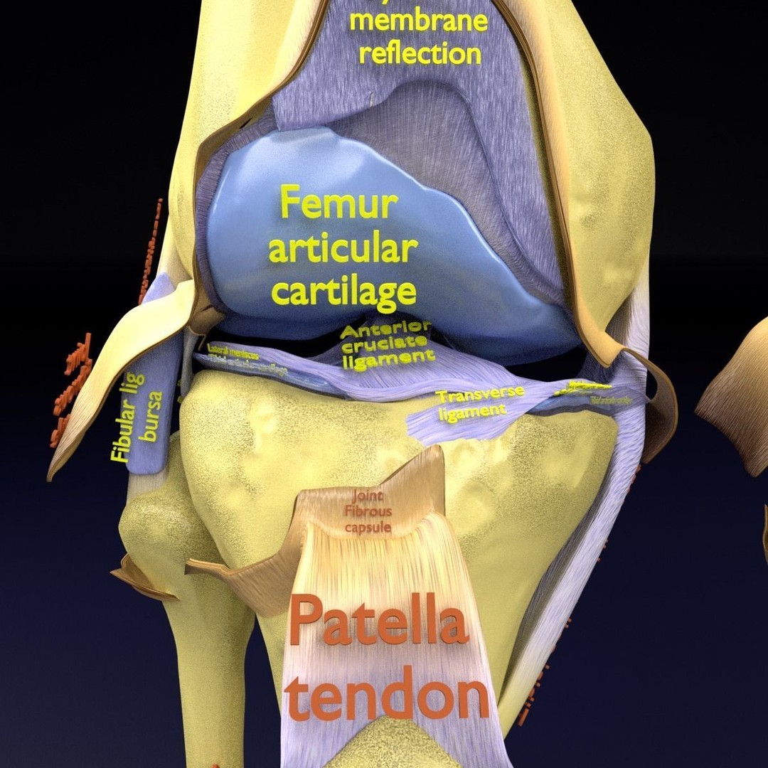 Osteoarthritis 3D Model – Medical Anatomy with Detailed Staging - View 25