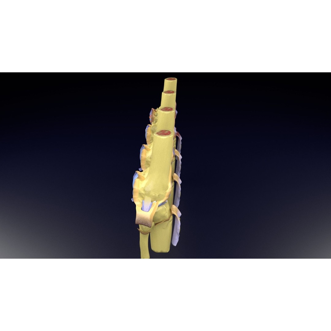 Osteoarthritis 3D Model – Medical Anatomy with Detailed Staging - View 40