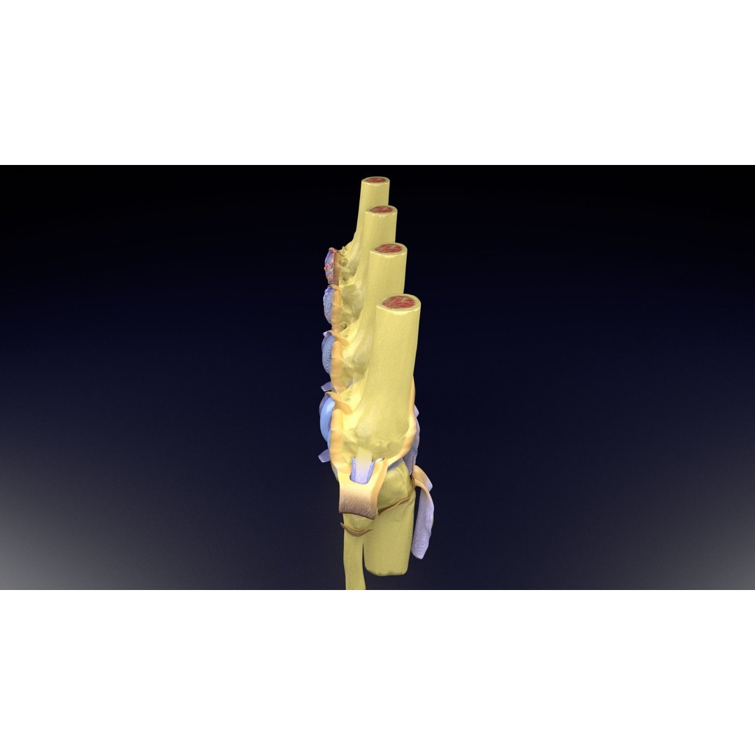 Osteoarthritis 3D Model – Medical Anatomy with Detailed Staging - View 41