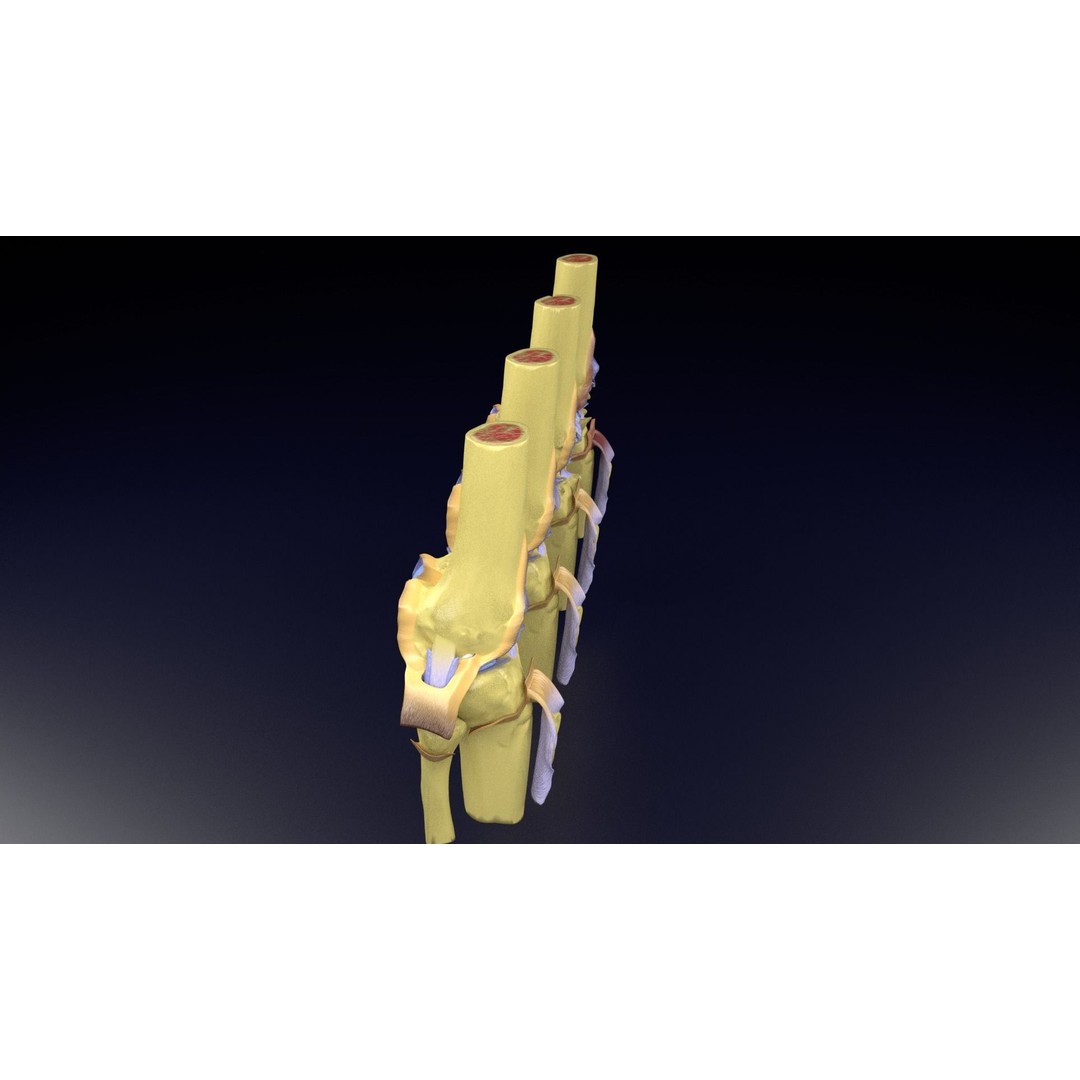 Osteoarthritis 3D Model – Medical Anatomy with Detailed Staging - View 44