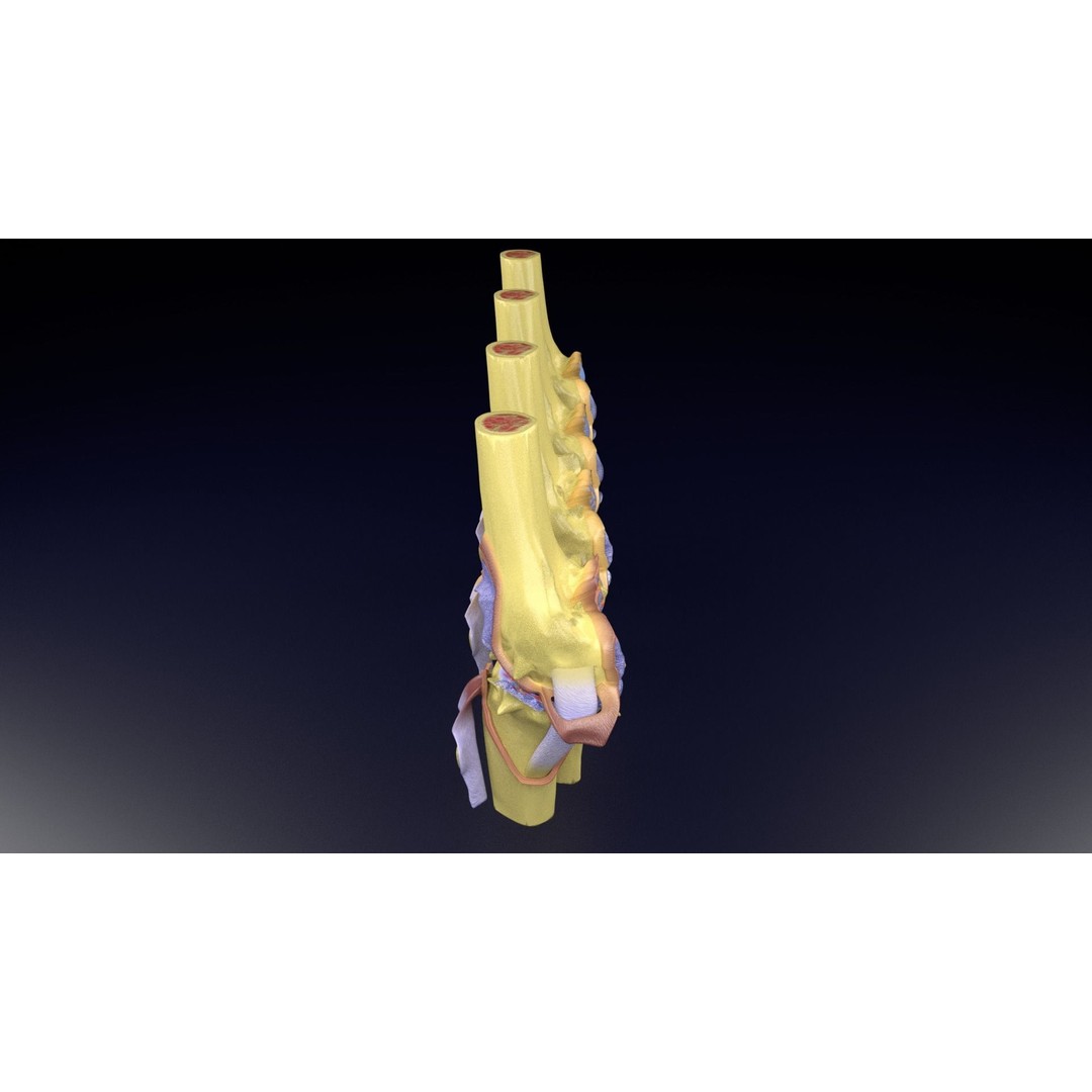 Osteoarthritis 3D Model – Medical Anatomy with Detailed Staging - View 72