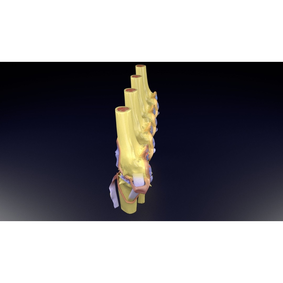 Osteoarthritis 3D Model – Medical Anatomy with Detailed Staging - View 73