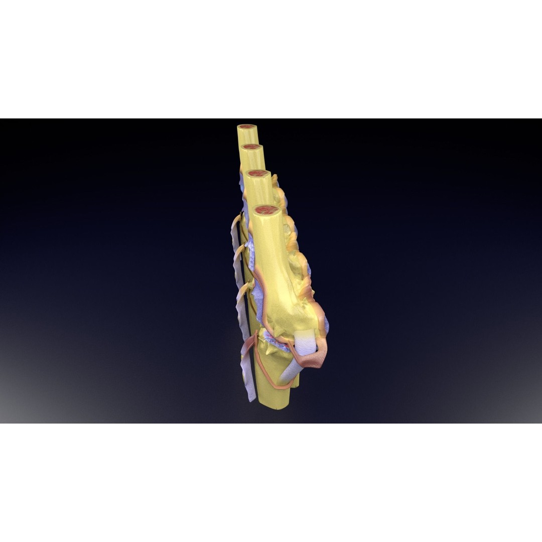 Osteoarthritis 3D Model – Medical Anatomy with Detailed Staging - View 74