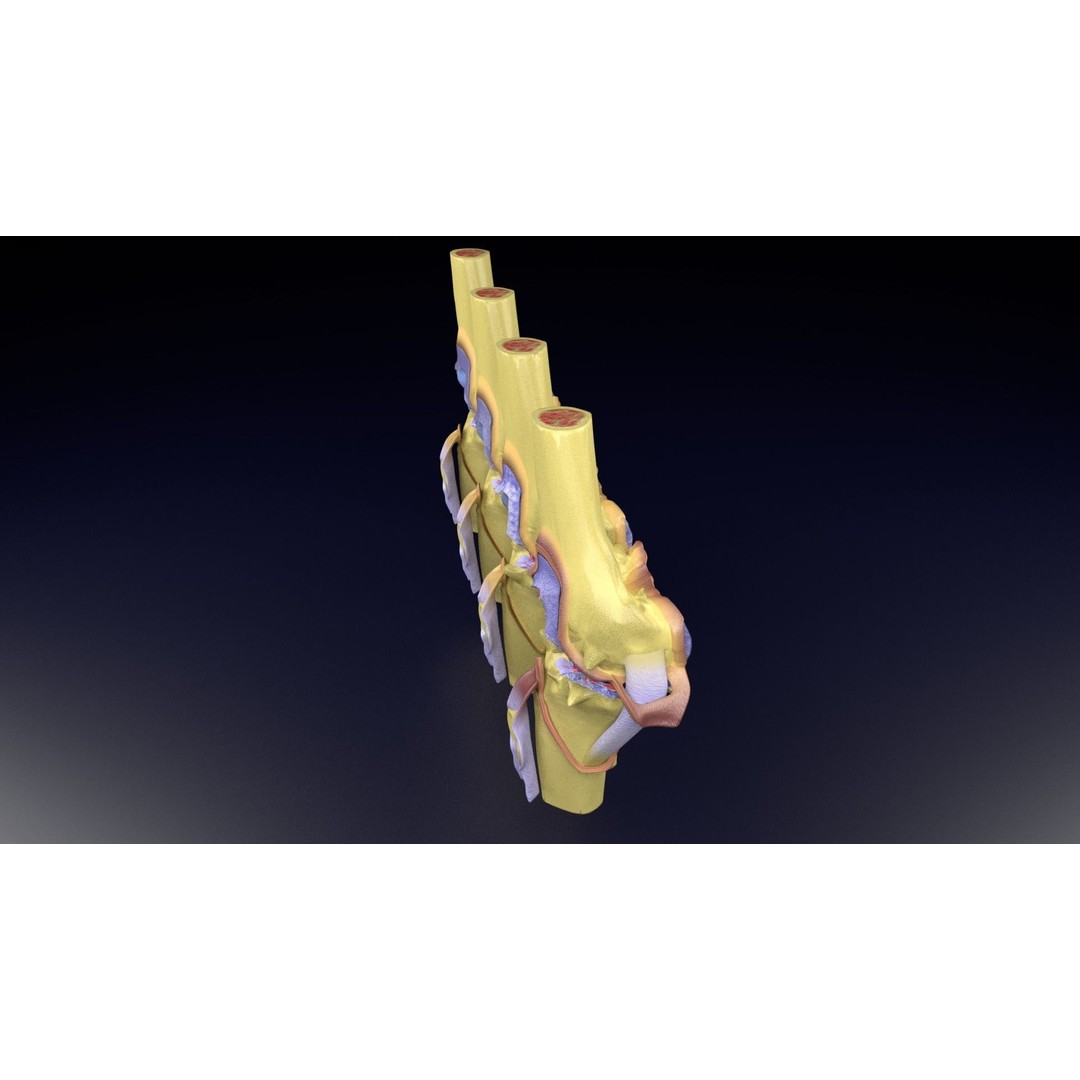 Osteoarthritis 3D Model – Medical Anatomy with Detailed Staging - View 75