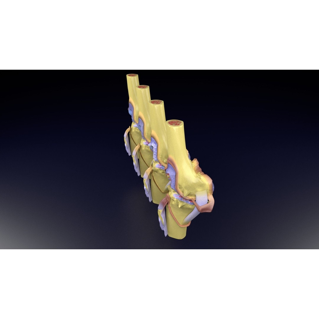 Osteoarthritis 3D Model – Medical Anatomy with Detailed Staging - View 76