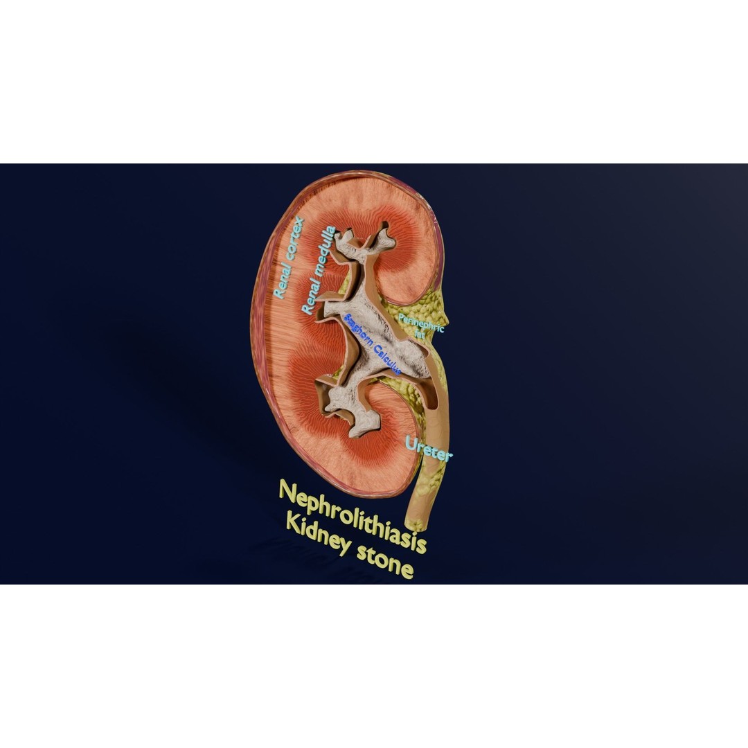 Kidney Stone 3D Model – Low Poly Medical Asset, PBR Textures, FBX - View 15