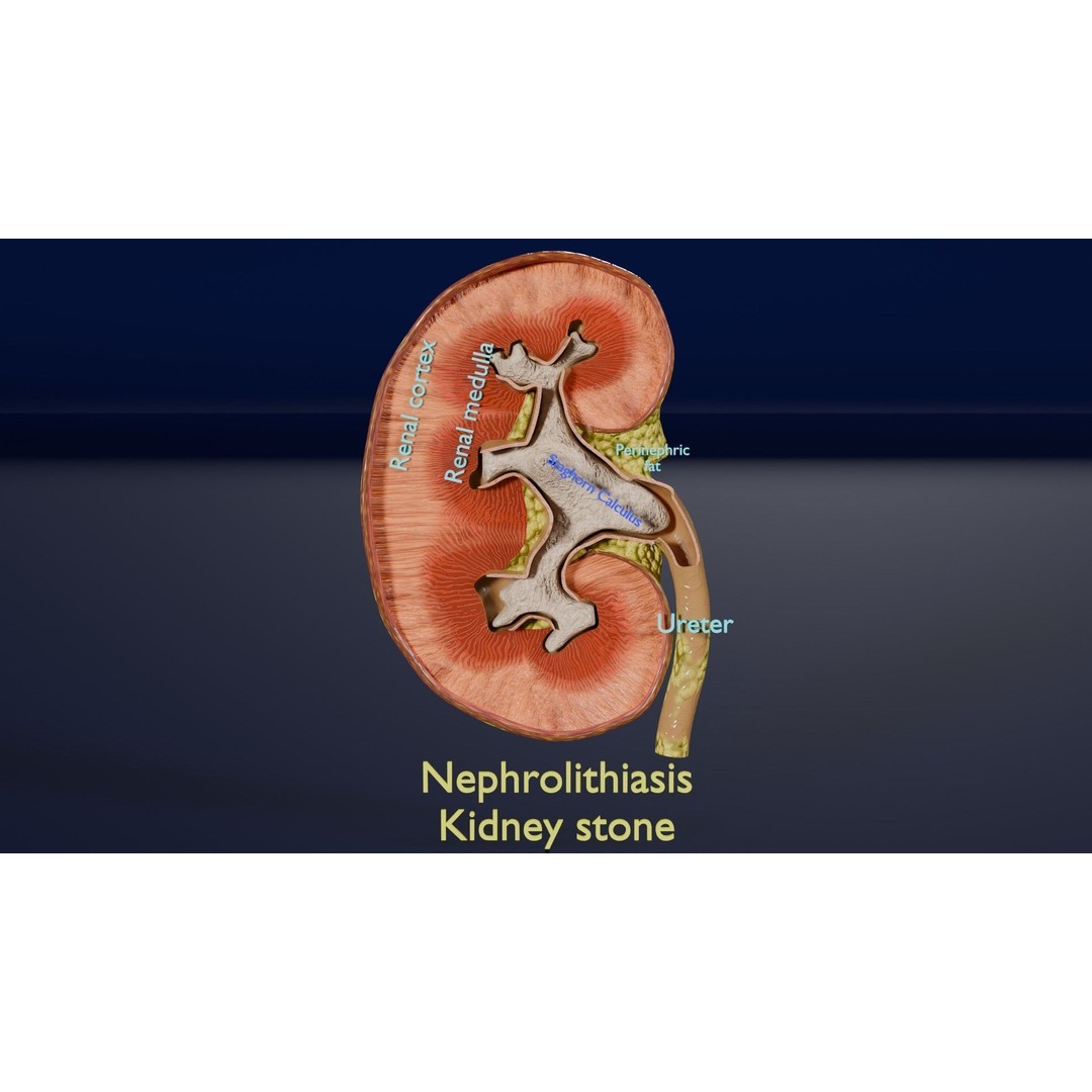 Kidney Stone 3D Model – Low Poly Medical Asset, PBR Textures, FBX - View 16