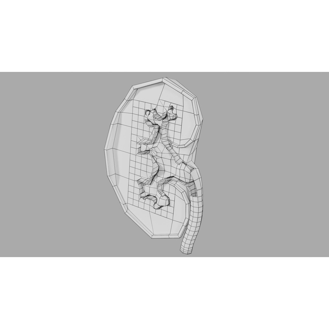 Kidney Stone 3D Model – Low Poly Medical Asset, PBR Textures, FBX - View 22