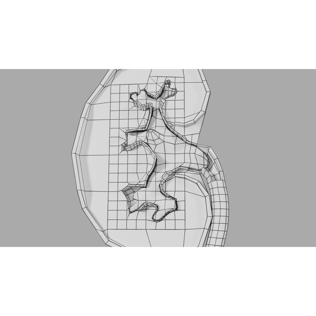 Kidney Stone 3D Model – Low Poly Medical Asset, PBR Textures, FBX - View 25