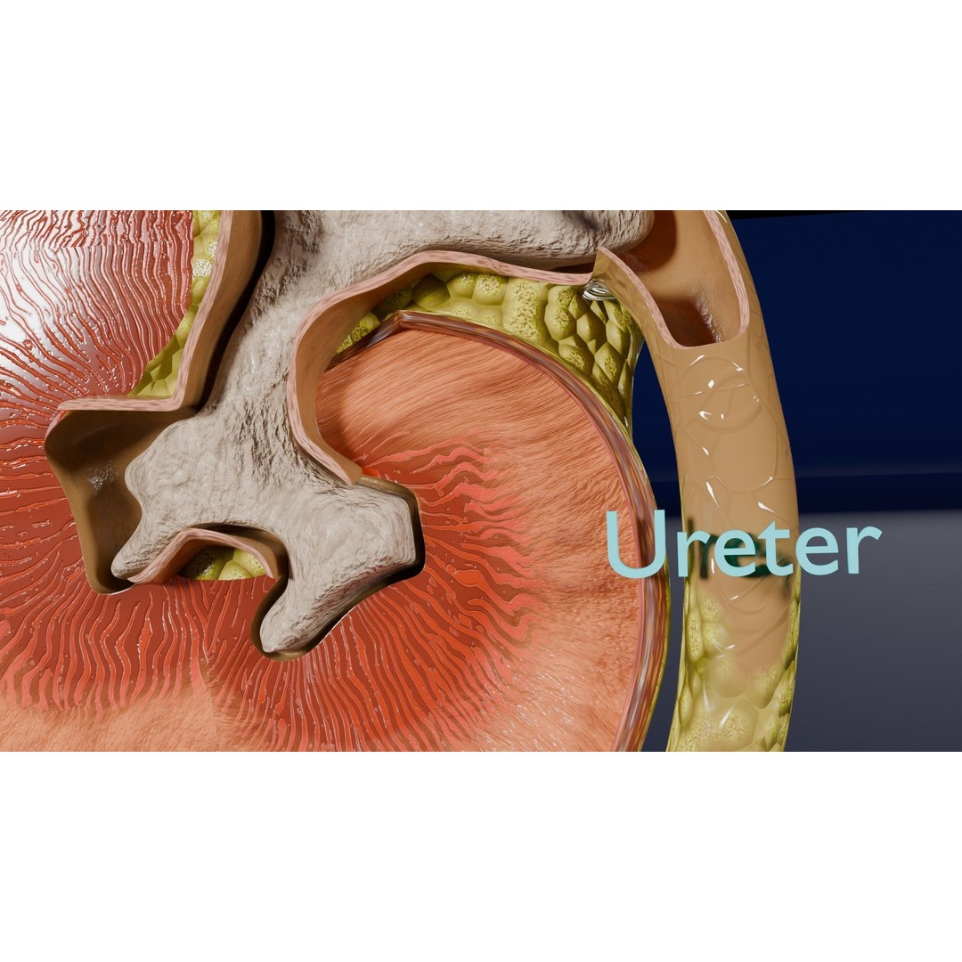 Kidney Stone 3D Model – Low Poly Medical Asset, PBR Textures, FBX - View 7