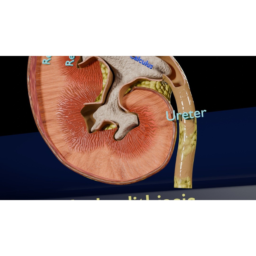 Kidney Stone 3D Model – Low Poly Medical Asset, PBR Textures, FBX - View 9