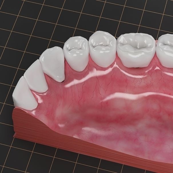Dental Implant 3D Model – PBR Animated Medical Asset, FBX & OBJ - View 10